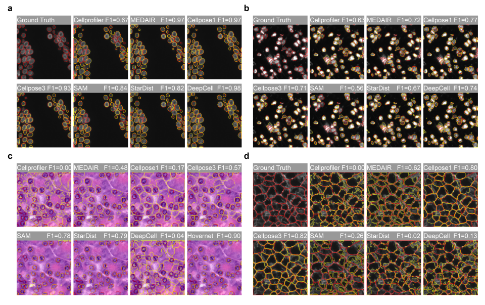 Figure 3. Representative cell segmentation results of different models across various staining modalities(1)